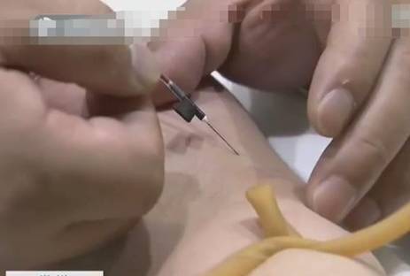 生活|男子身体感到异常去医院，仔细检查后，医生：你都爆表了！