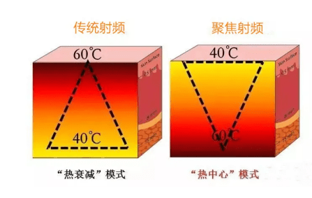 玛吉|yyds：5代热玛吉？热玛吉有什么效果和副作用？抗衰秘密武器！