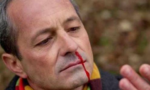 症状|肝脏健不健康，这几个地方就能看出来，一般很难藏住！