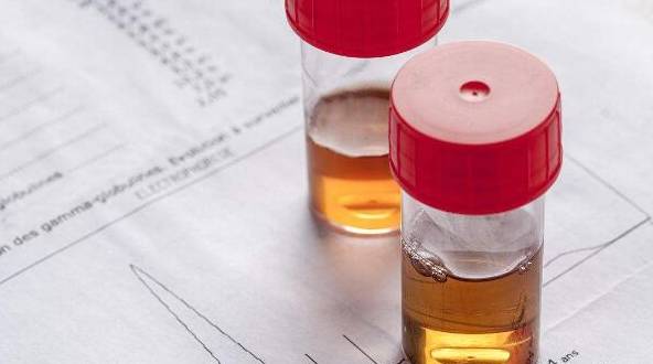 症状|肾病医生：蛋白1+和轻度水肿哪个严重？你可能也猜错了