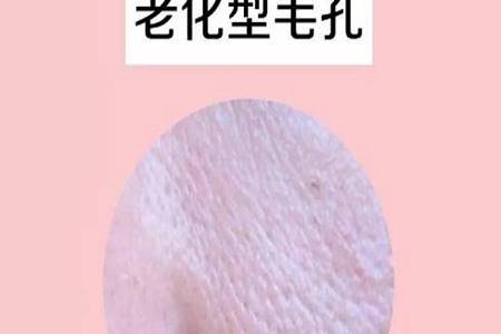 姐妹|毛孔粗大怎么办？想要改善皮肤问题，这4个步骤非常重要