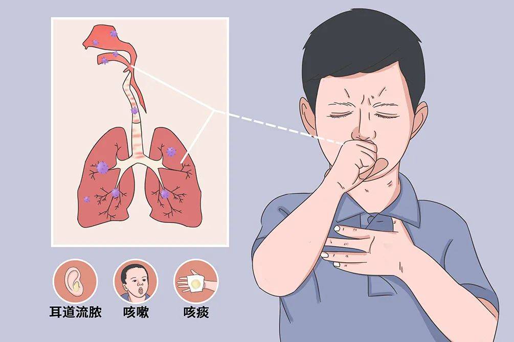 饮食|是否支气管扩张患者,都值得一看