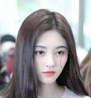 整形|整形整的有辨识度是种什么样的体验?