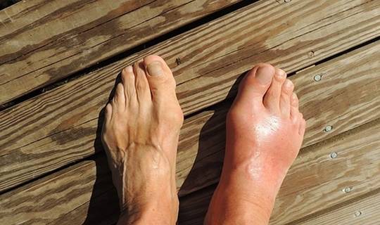 肾脏|这4种疾病看似和肾没关系，却在悄悄地伤肾！