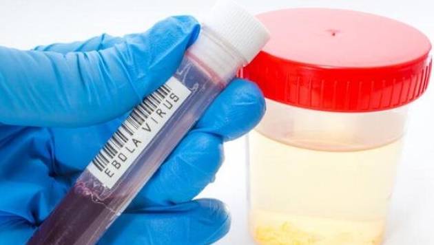 肾脏|预防尿毒症,别只盯着肌酐、蛋白尿,还有6点不可或缺