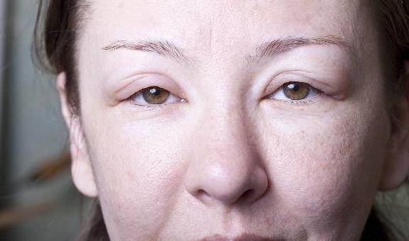 症状|肾病早期，晨起后可能会有这4种“症状”，若你全没中，偷着乐吧