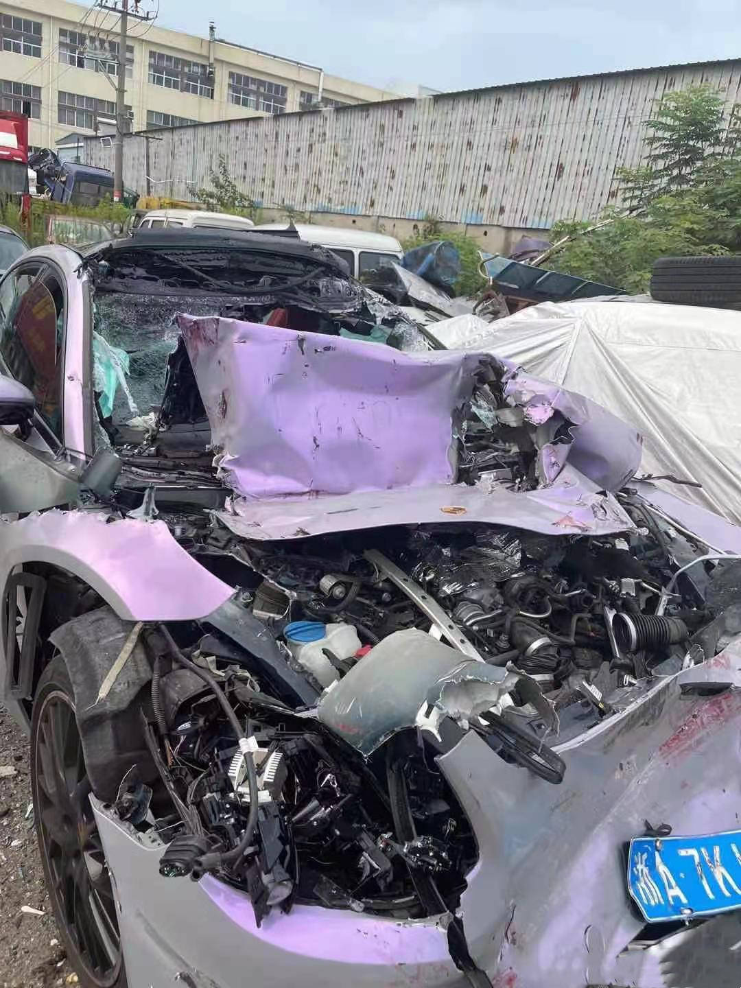 原创王逗逗晒出恋人车祸照眼皮青紫又流血万幸只是皮肉伤