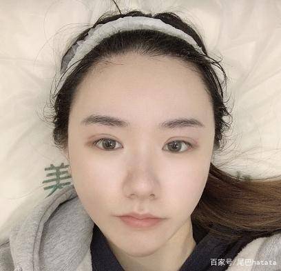 opt|不同超光子嫩肤之间该如何选择？