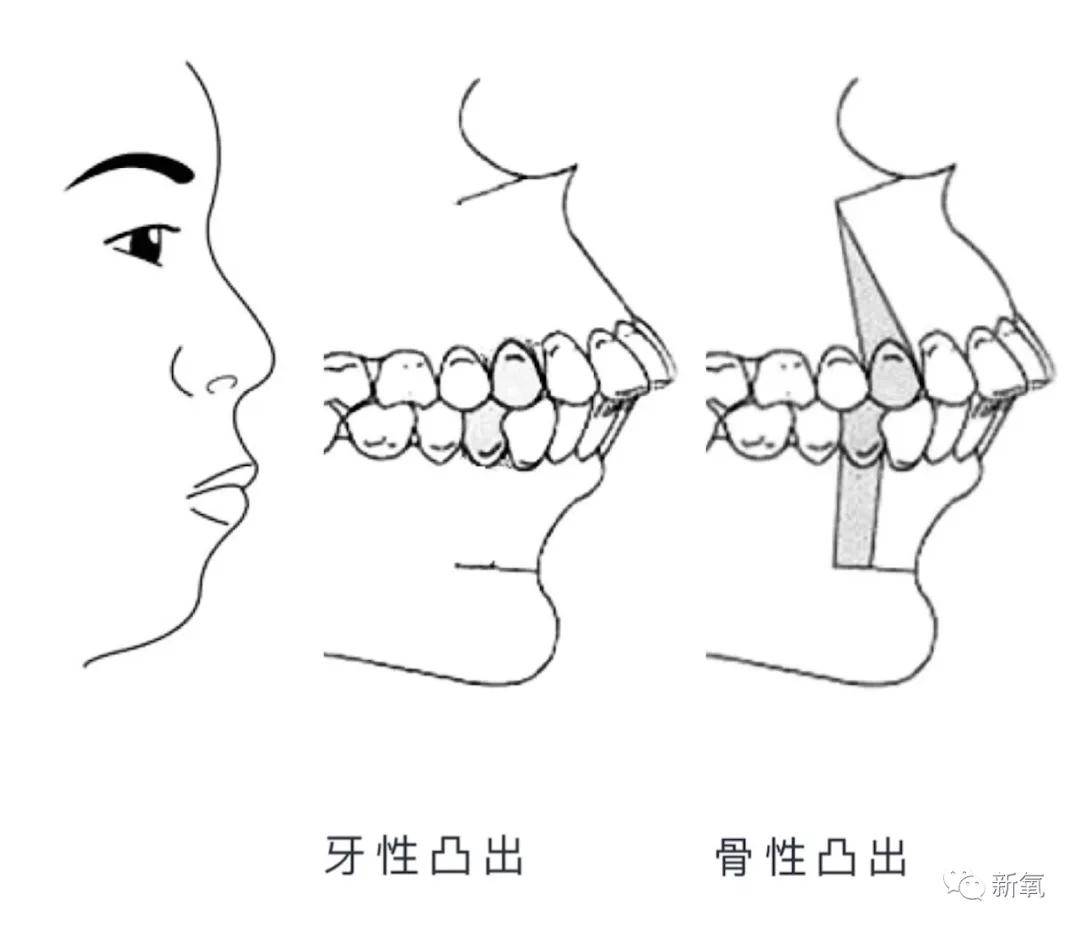 平面|作为被力捧多次的古偶女主,侧颜却被男主吊打的还第一次见