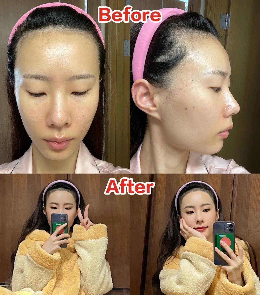 调整|赵露思调整发际线后显瘦10斤?提升颜值,拯救发际线小妙招来了!