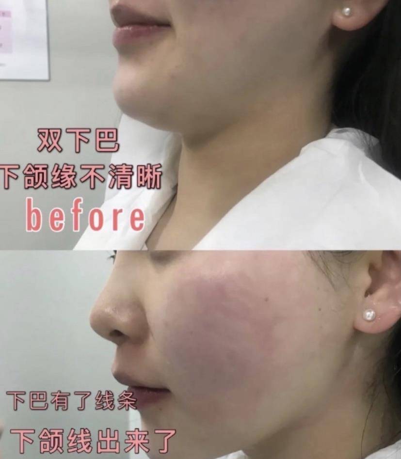 缺点|盘点2021年上半年我做过的皮肤项目！