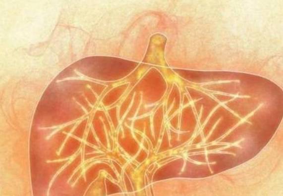 严重|肝不好的人,身体会有14个信号,若你超过10个,肝已“烂如渔网”