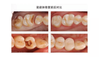 d9502f09366d4c33b496a21c55002f38.png