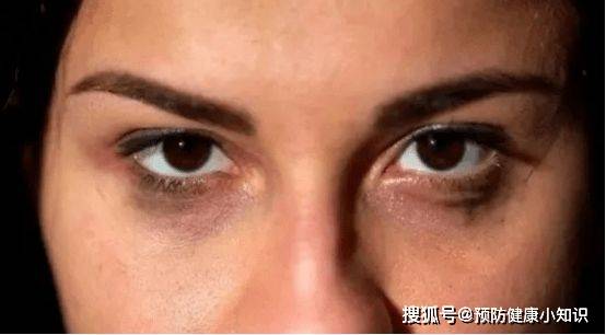 功能|身体4种变化，肝或已慢慢“硬如石块”，若你没有，偷着乐吧