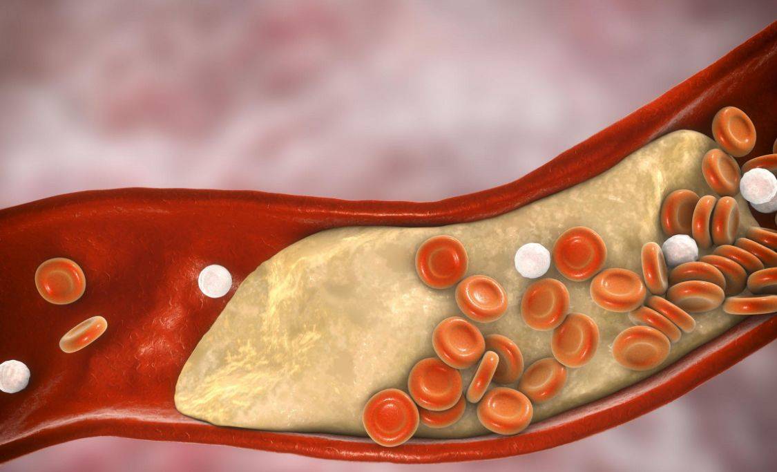 症状|为何年轻人容易出现血液粘稠的症状?医生:或与这3大因素有关
