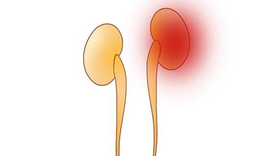 水液|查出尿毒症的人，不断增多，与什么有关？尿毒症早期，有何表现？