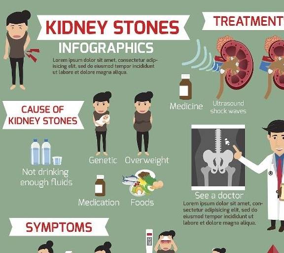 物质|常喝啤酒会得肾结石？片面了！喝对了还可预防结石的产生！