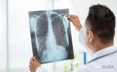 免费筛查癌症是真的吗 a68bcbc0a288495d85bab253fe6096bc.png