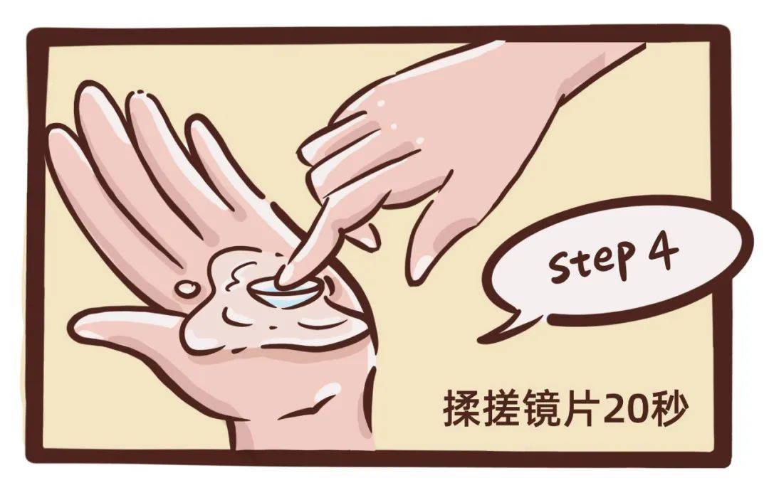 角膜塑形镜日常除蛋白应该怎么做
