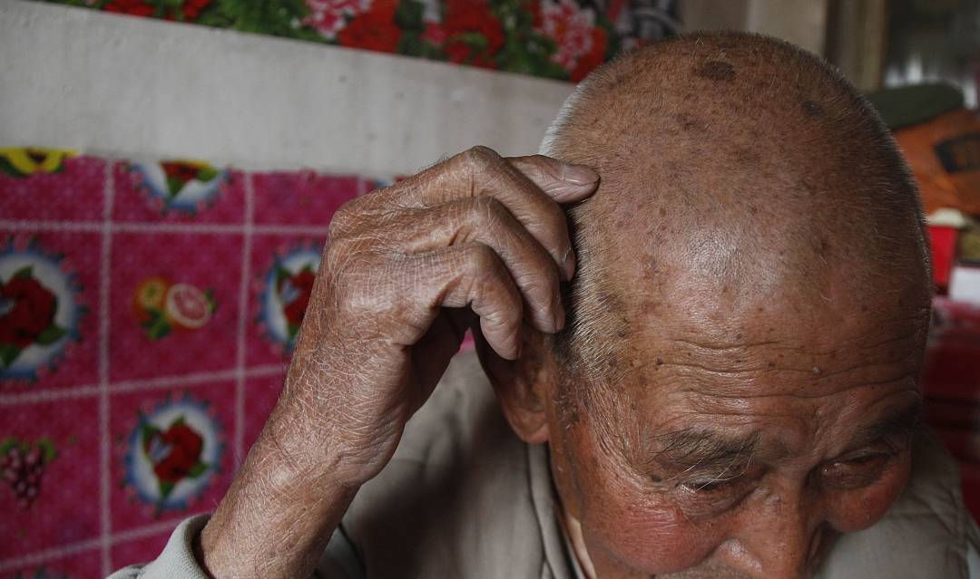 疱疹的后遗症神经痛怎么办 2f16bf565bc849a9b21680b9716330b3.jpeg