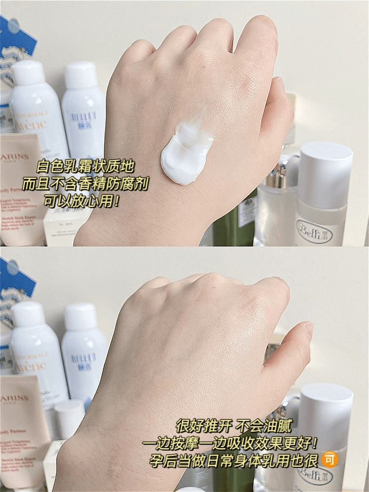 产品|妊娠纹也是“看碟下菜”?教你如何有效淡化妊娠纹,少交智商税!
