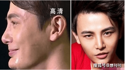 综合|眼鼻综合买一送一？满屏都是欧双高鼻梁，不是亲生就是一个医生