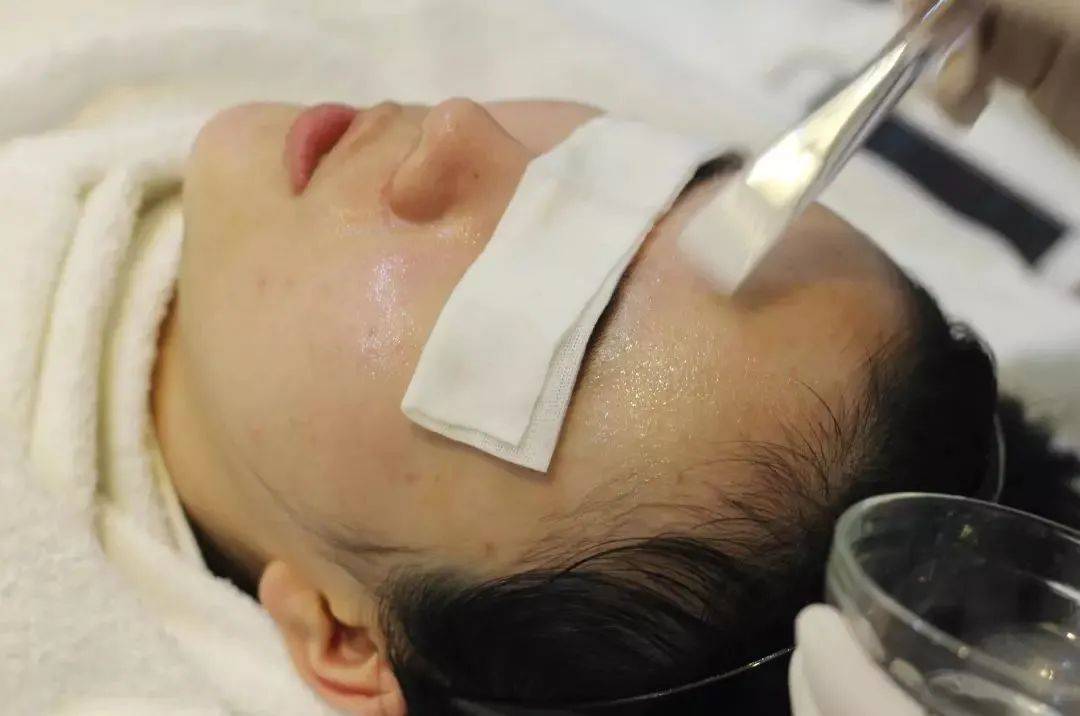 因为|痘肌医美能做哪些？治疗痘痘还能改善肤质~