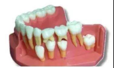 小孩一般几岁换牙呀 14d076a7979c4bf099b0d65d9c8e718e.jpeg