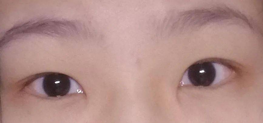 张力|五官C位可不能随便动,鼻综合也不是人人适合!