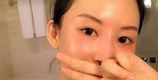 面色|血糖高的人，脸上若没有这4个“变化”，恭喜你！状态可能还不错