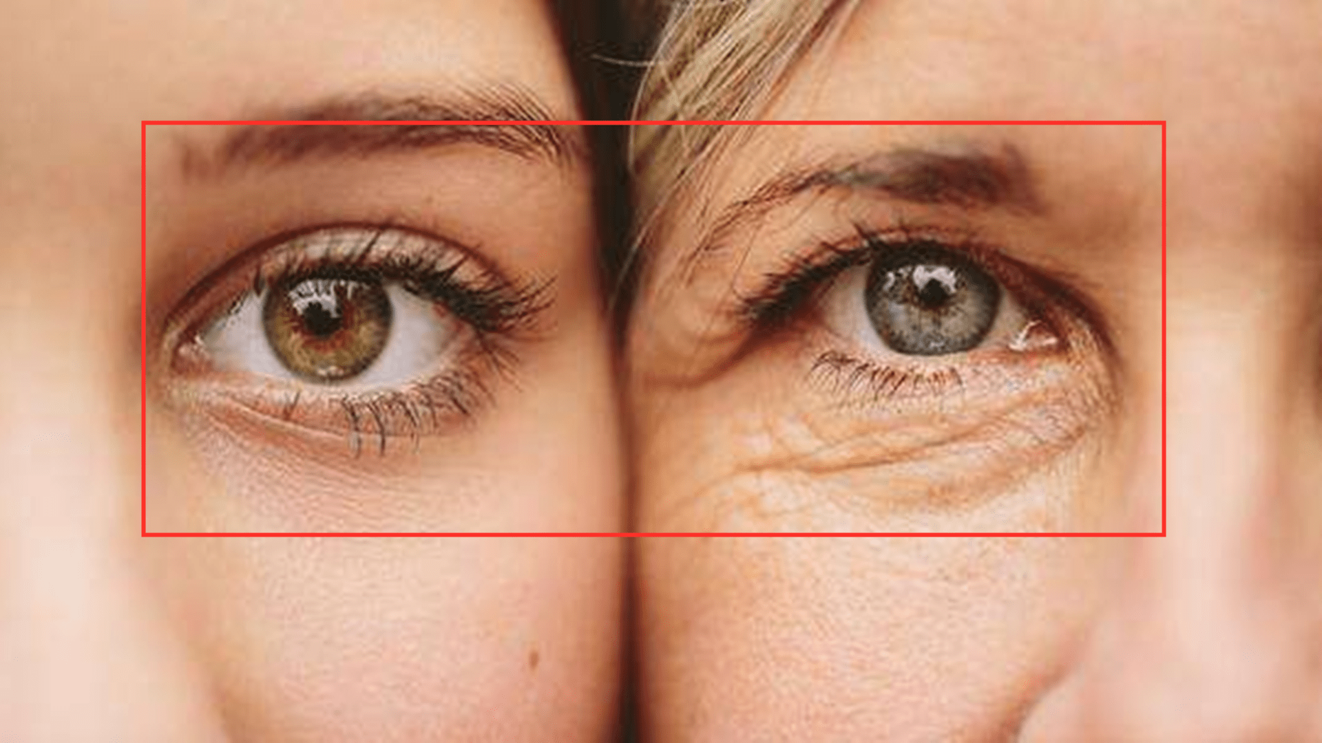 祖国|14岁女孩面容比母亲还老？少女患稀有怪病，长相衰老严重