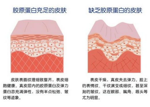 观点评论|伊的家的胶原蛋白是真的吗？胶原蛋白肽果味饮是什么？