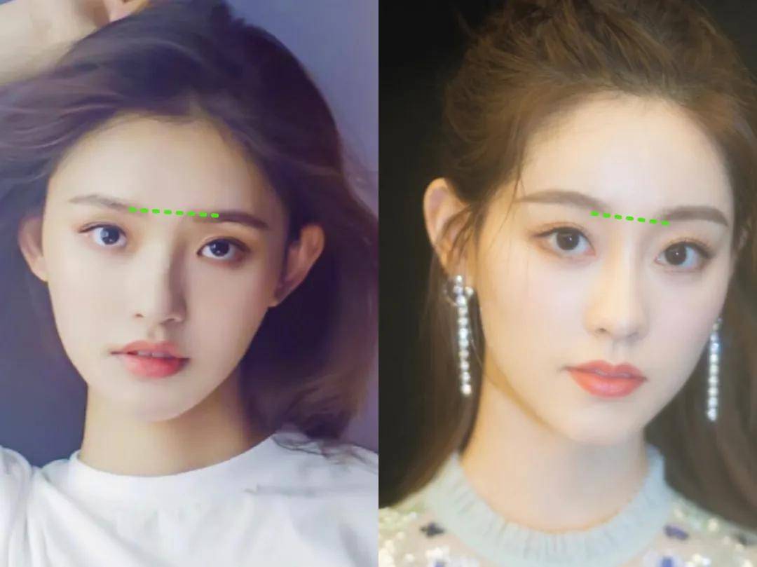 因为|姐妹，双眼皮再好，咱也别硬割啊！