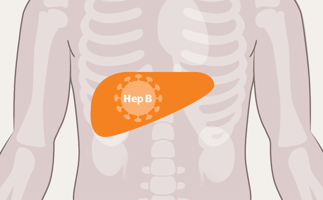 技术|目前的医疗技术，能不能让乙肝转阴？医生道出实情