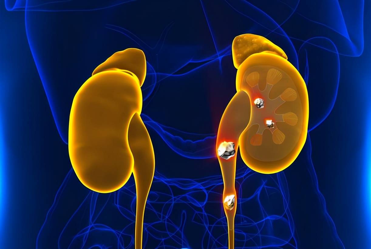 严重|“泡沫尿”提示肾病?碰到这4种情况,或许不用太紧张!