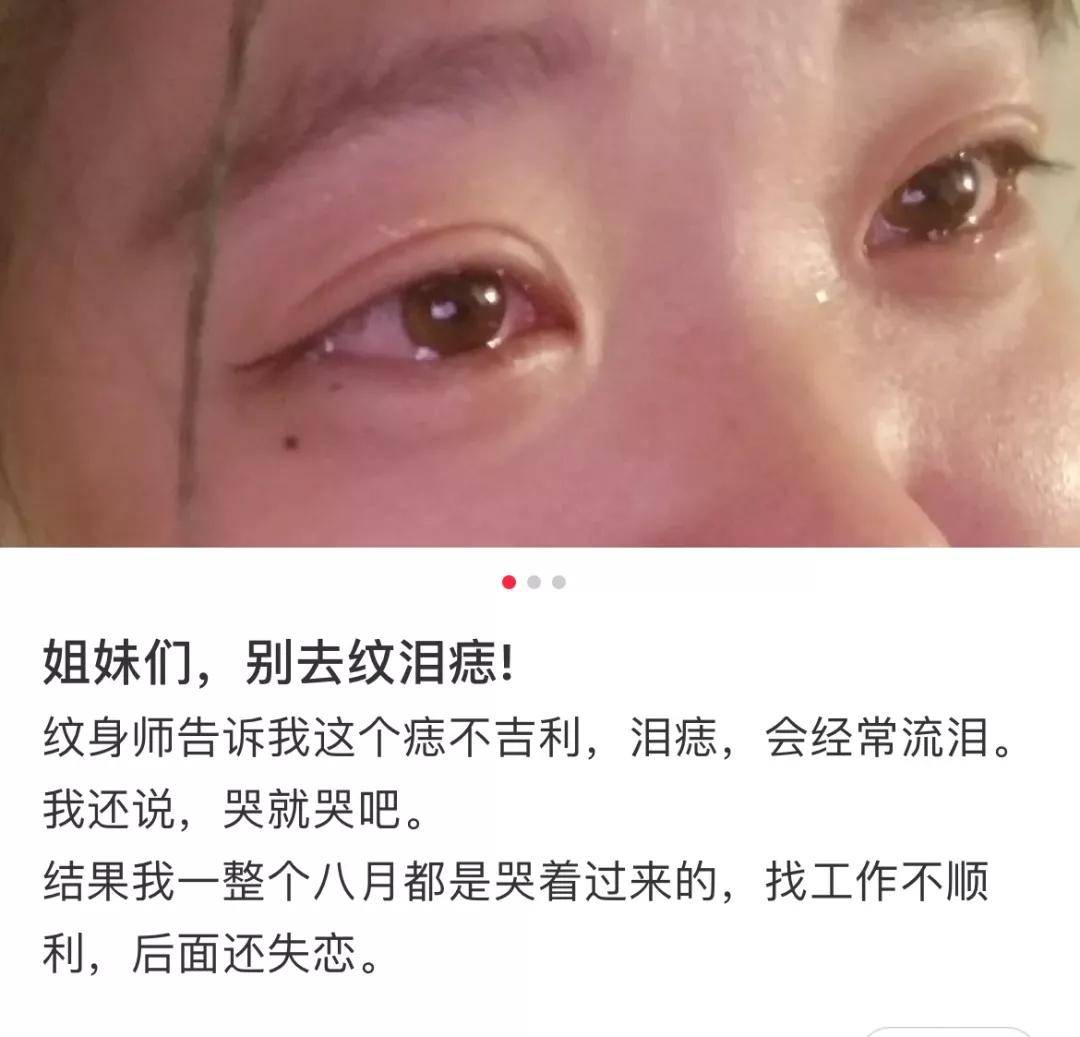 平面|姚安娜没救了，别人点痣变美人，她点痣变男人