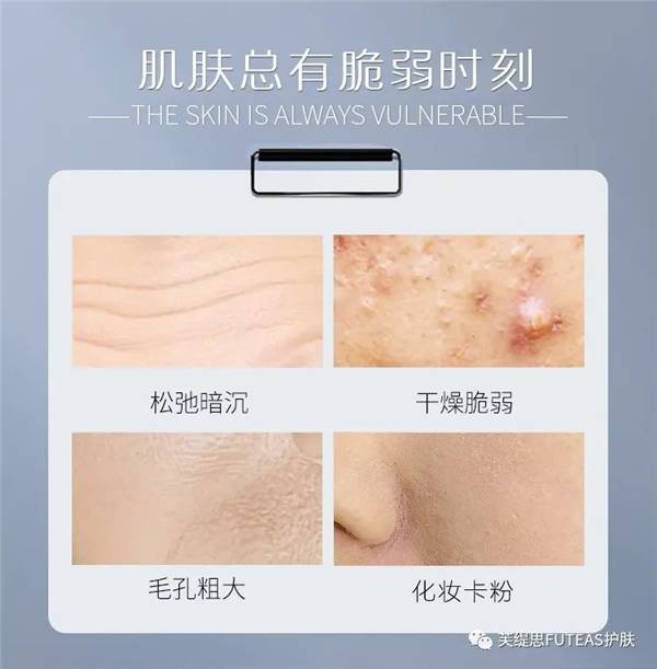 底子|芙缇思青春焕肤喷雾——时刻呵护美肌