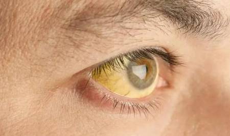 眼睛|体内有癌,眼睛先知,眼睛若出现一个特征,肝脏部位最好检查一下