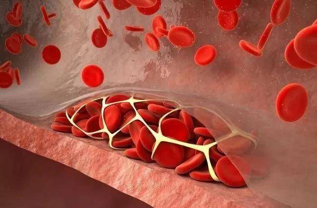 什么原因会引起血脂高 d4948d4556e1421d83c0263ccace1e41.jpeg