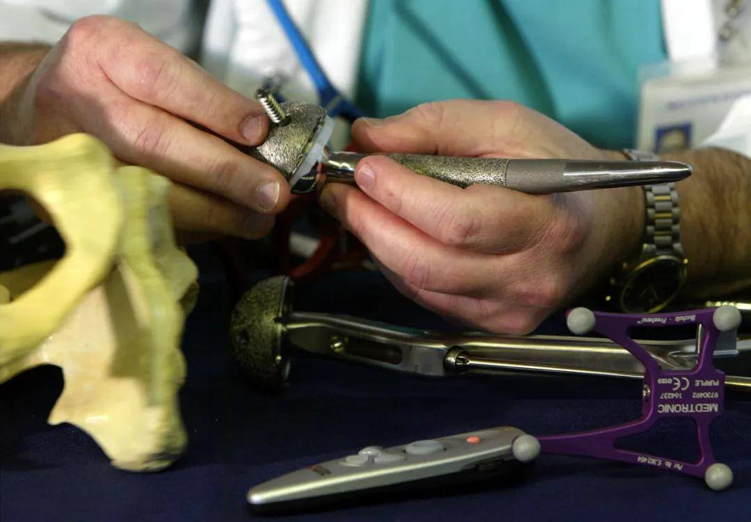 手术|心脏支架集采后的种种问题会否出现在人工关节领域？