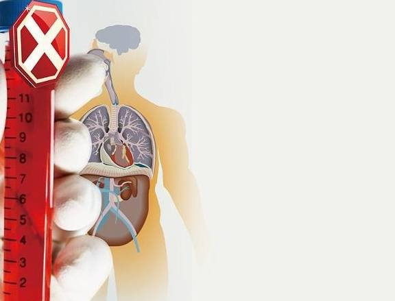 肝脏|如何预防乙肝复发?做好这4件小事,不给它留机会