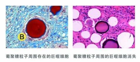 品牌|再生医美新风口，心辰品牌如何引领再生材料新方向