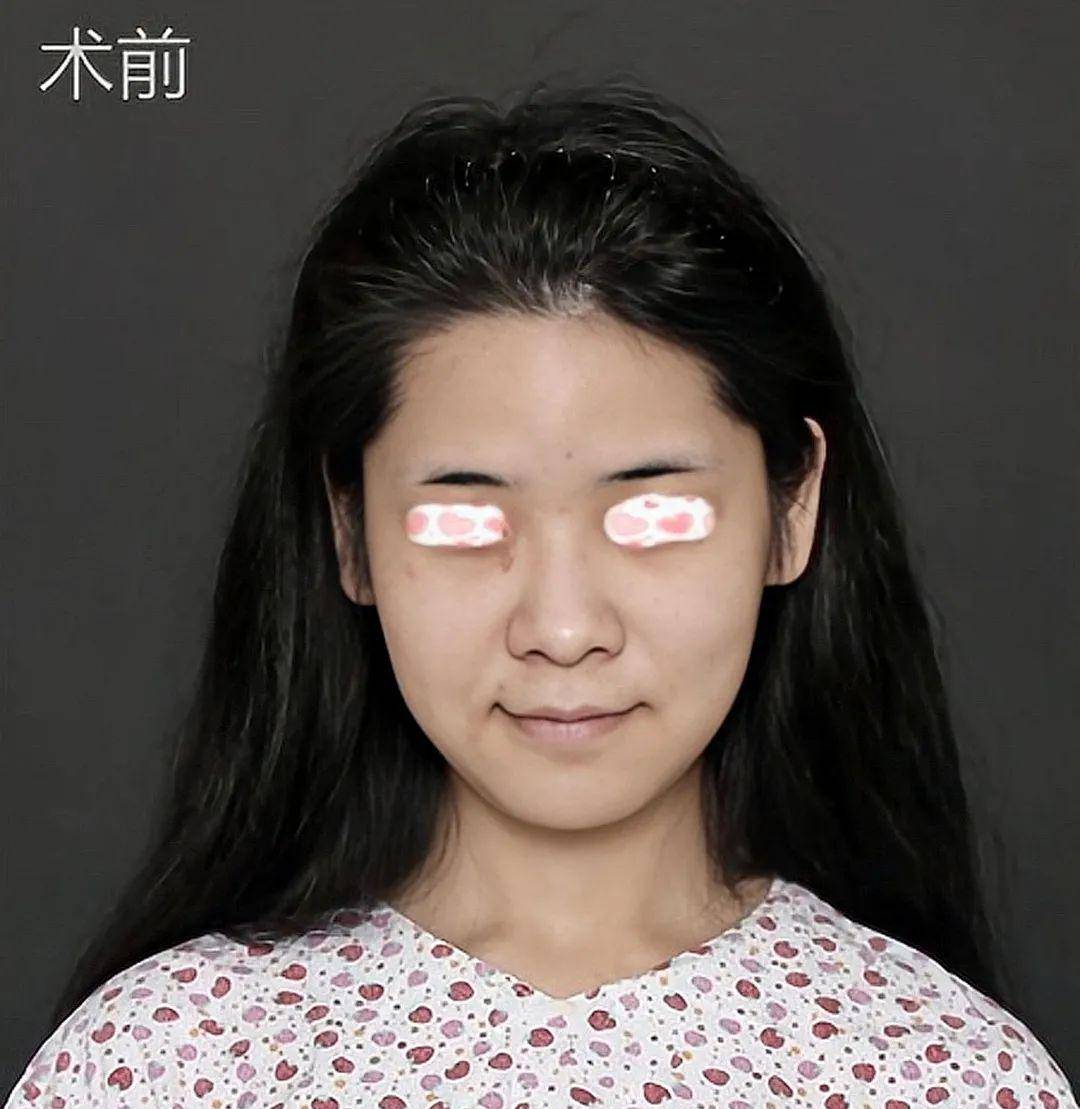 丑是真|她他们的鼻子到底丑在哪儿？