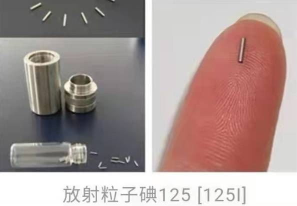 肿瘤|咸阳市中心医院开展不开刀颅内肿瘤放射性粒子植入术