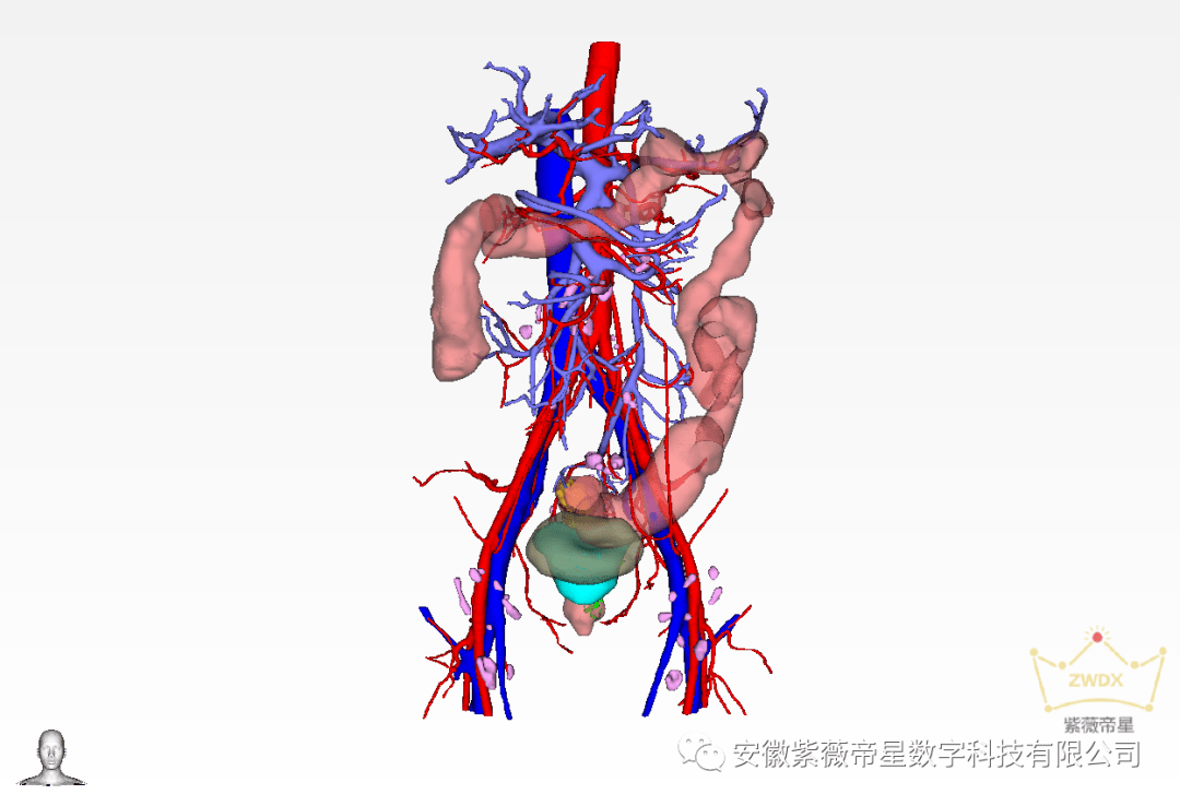三維可視化正面圖病變與動脈血管關係圖病變與靜脈血管關係圖病變與門