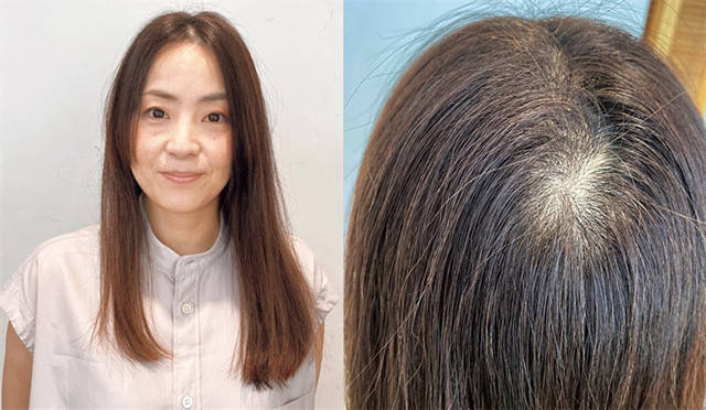 脸部|40+女人会有露头顶发旋困扰，8种方式来轻松遮盖，及带来减龄效果