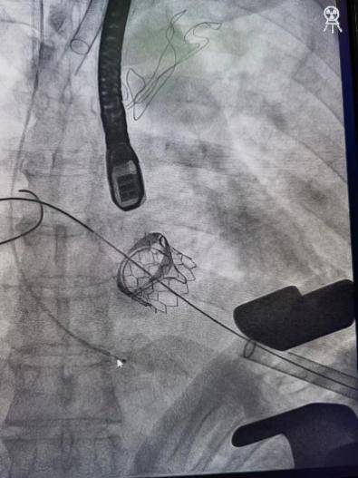 生命线|奔波在生命线上的心外人