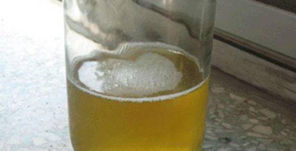 大意|身体三个部位比较“臭”,别大意!或是肝脏在向你求救