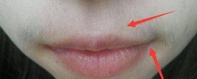 脸部|女性开始衰老时，脸部通常会“出卖”你，看看你占了几个？
