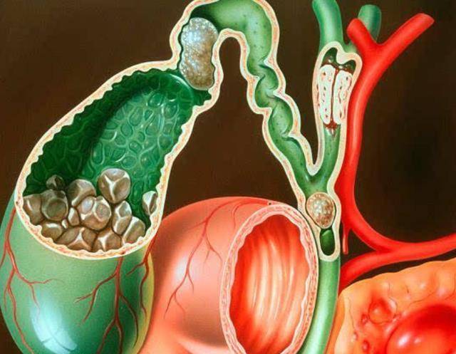 生活|人体的八个器官或可以“拿掉”，且不会影响正常生活，是真的吗？